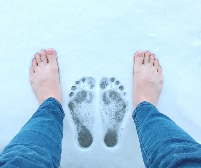 gel-toe-separator-pack